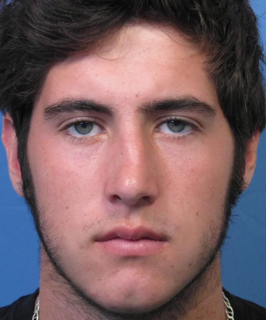 A young man with short dark hair and sideburns against a blue background, looking directly at the camera with a neutral expression.