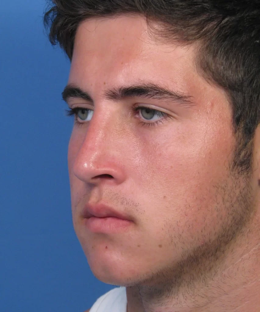 Profile of a person with short hair and facial stubble against a blue background.