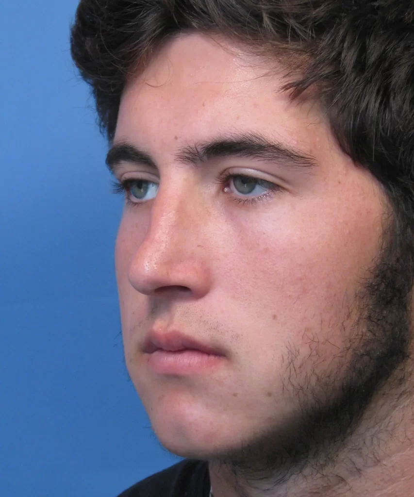 A close-up of a person with blue eyes and a neutral expression, against a blue background.