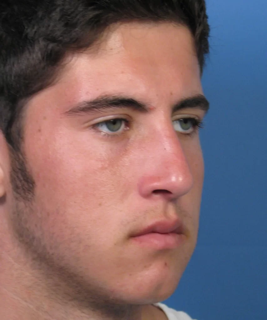 A close-up of a young man's face with short dark hair, light skin, and a neutral expression, set against a blue background.