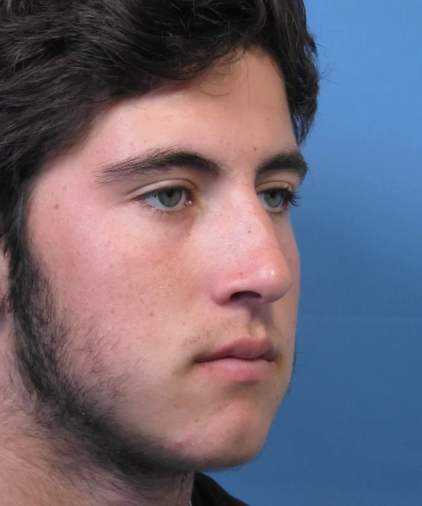 Profile view of a young man against a blue background.