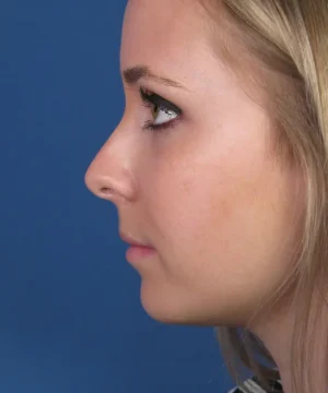 Profile view of a person with blonde hair against a blue background.