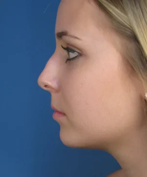 Profile view of a person with light-colored hair against a blue background.