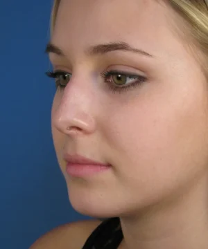 Side profile of a person with light skin, green eyes, and blonde hair against a blue background.