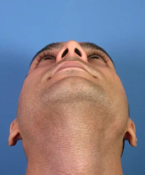 A person looking upward with a close-up view of their neck and chin against a blue background.