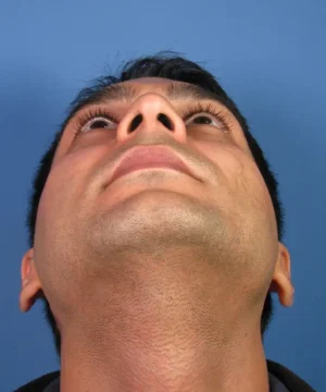 Close-up of a person looking upwards against a blue background, showing the underside of the chin and nose.