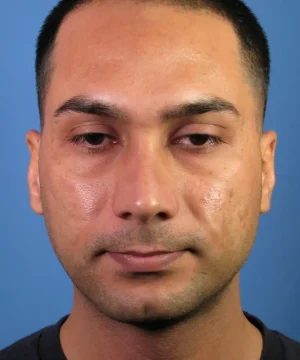 A man with short hair and a neutral expression against a blue background.