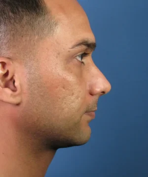 Profile view of a man against a blue background, showing his facial features and short hair.