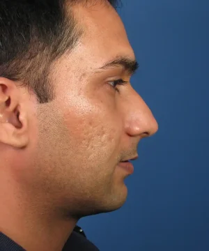 Profile view of a person with short dark hair against a solid blue background.