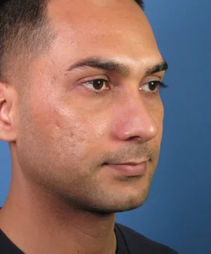 Headshot of a person with short hair and a neutral expression against a blue background.