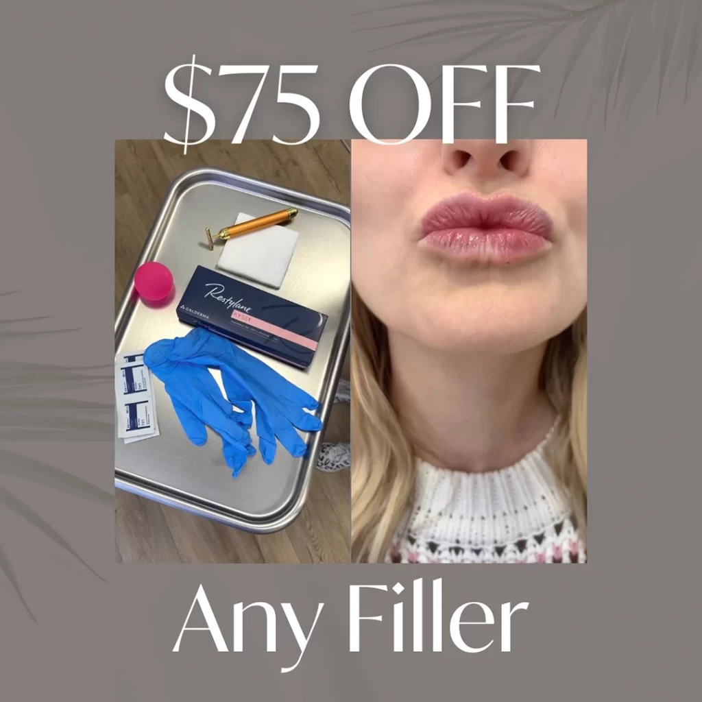 Medical tools, gloves, and a package on a tray; close-up of a woman's lips. Text reads "$75 OFF Any Filler.