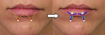 Side-by-side comparison of a person's chin with overlaid markings and lines, highlighting skin tension points and movement direction with arrows.