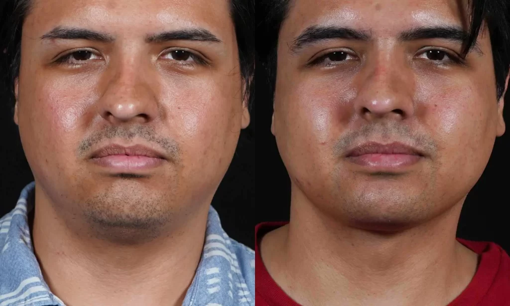 Close-up of the same man's face in two images side-by-side, showing subtle differences in expression and lighting.