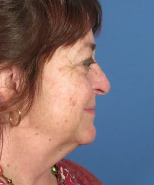 Profile view of an older woman with short brown hair, wearing hoop earrings and a patterned top, against a blue background.