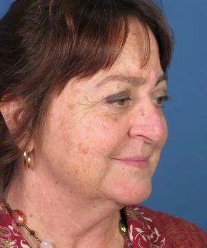 A woman with short brown hair, wearing earrings and a necklace, is seen in profile against a blue background.