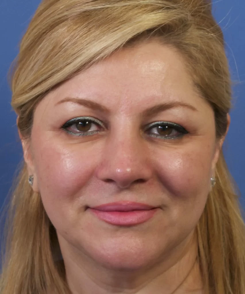 Portrait of a woman with blonde hair against a blue background, wearing makeup with eyeliner and pink lipstick.