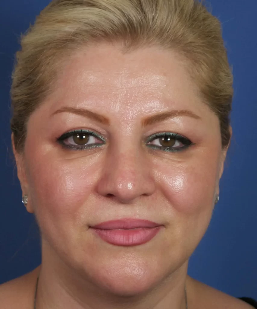 A woman with blond hair against a blue background, wearing makeup with green eyeshadow and peach lipstick.