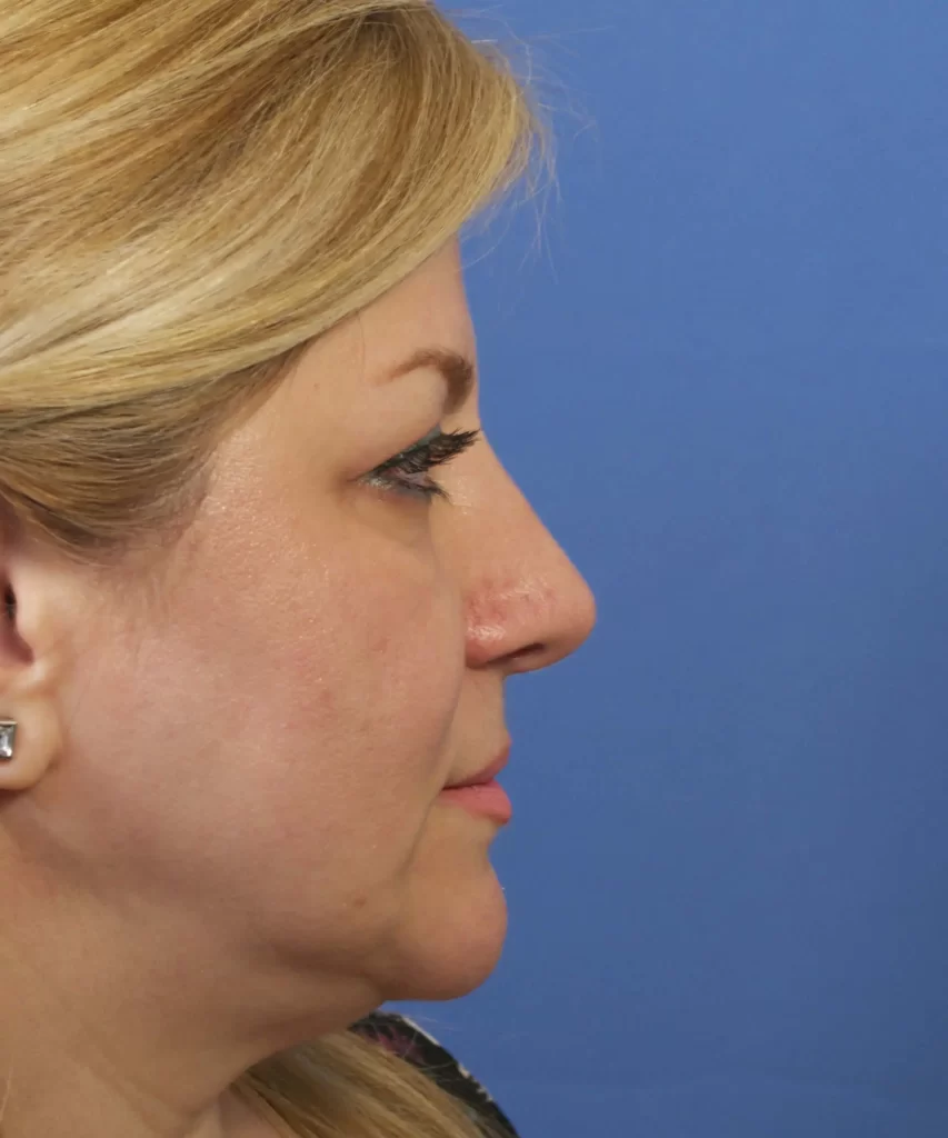 Profile view of a woman with blond hair against a blue background.