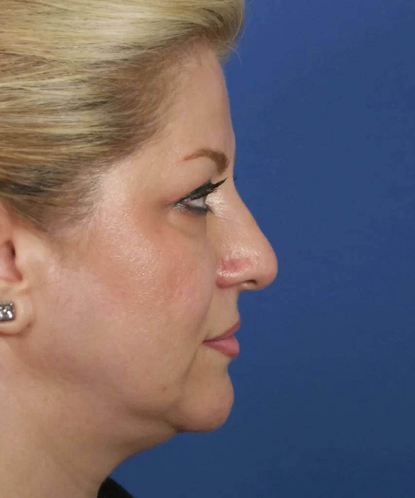 Profile view of a person with blond hair set against a blue background.