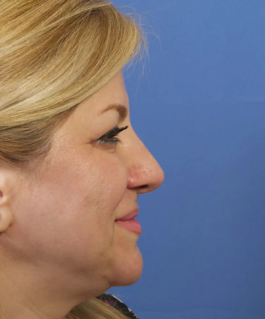 Profile of a woman with blonde hair against a blue background.