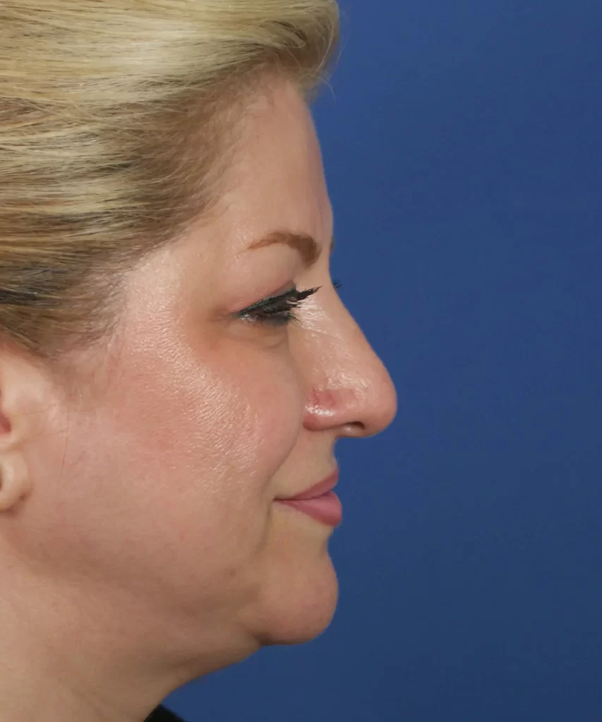 Side profile of a person with blonde hair against a blue background.