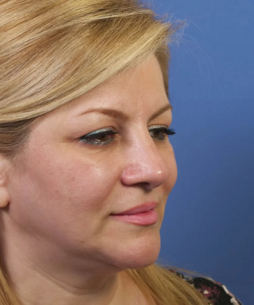 Side profile of a woman with blonde hair against a blue background.