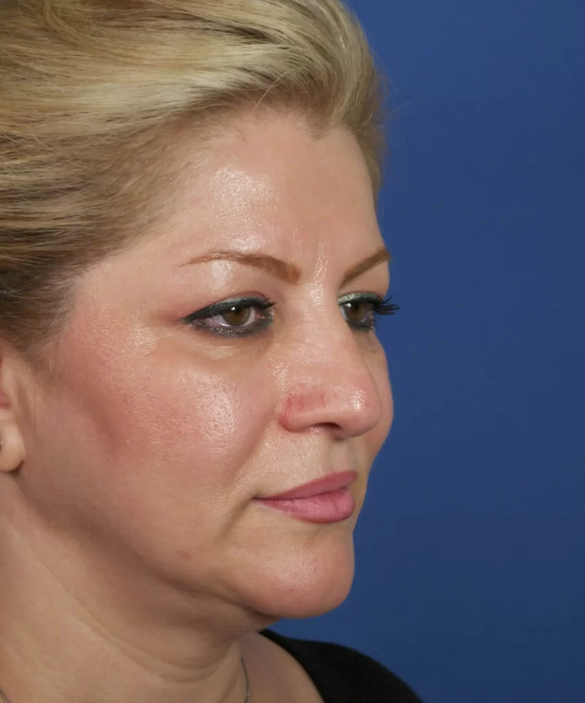 Profile of a woman with blonde hair against a blue background, showing clear skin and wearing eyeliner and pink lipstick.