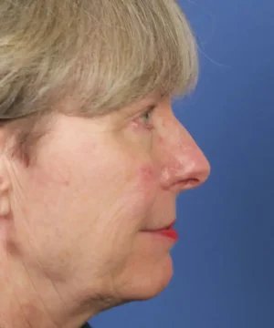 Profile view of an older woman with short gray hair against a blue background.