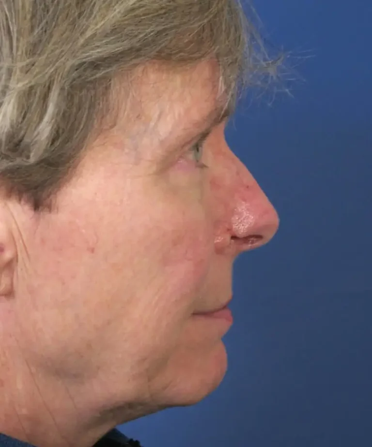 Profile view of a person with short, light-colored hair against a blue background.