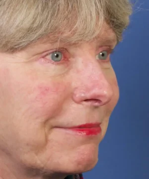 Profile view of an older person with short gray hair and red lipstick against a blue background.