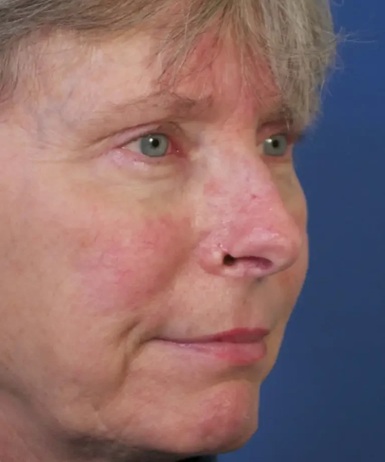 Close-up of a person's face with short light hair, fair skin, and green eyes, looking sideways against a blue background.