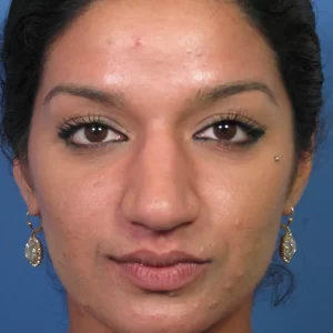 A person with dark hair, wearing earrings, looking straight ahead against a blue background.