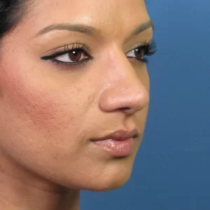 Close-up of a person with smooth skin and subtle makeup. Blue background.