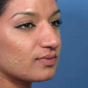 Close-up of a person's face with visible skin texture and smooth makeup, set against a blue background.