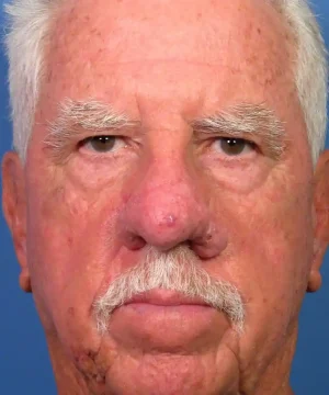 Elderly man with white hair, a mustache, and a serious expression, looking directly at the camera, against a blue background.