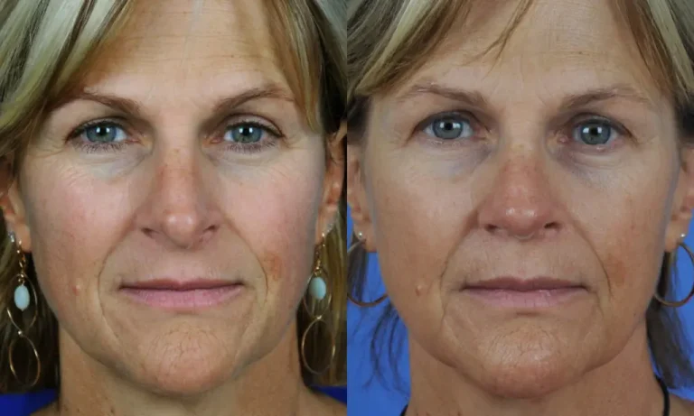 Close-up side-by-side comparison of a woman's face showing subtle differences in skin tone and texture.