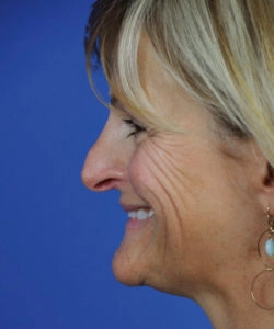 Profile of a smiling person with short blonde hair against a blue background.