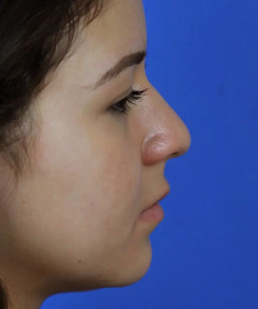 Profile view of a person against a solid blue background.