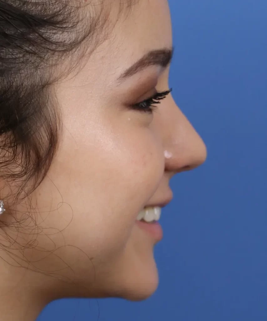 Side profile of a person smiling against a blue background.