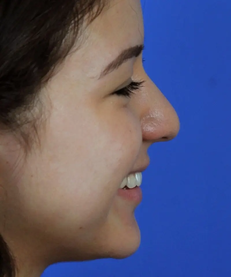 Profile view of a person smiling against a blue background.