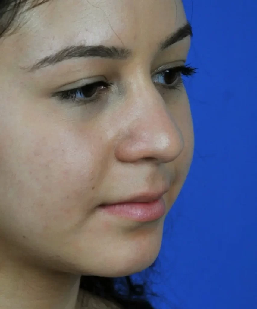 A close-up side profile of a person with a neutral expression against a blue background.