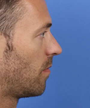 Profile view of a man's face with short hair and a beard against a solid blue background.