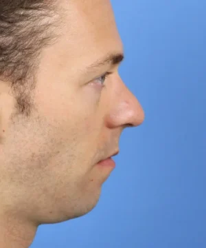 Side profile of a person with short brown hair against a blue background.