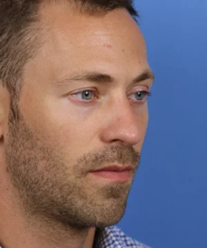 A man with short hair and a beard looking to the side against a solid blue background.