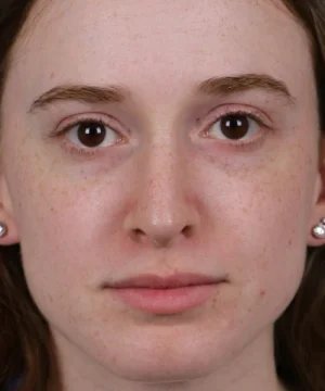 A person with long brown hair and freckles is looking directly at the camera. They are wearing earrings and have a neutral expression.