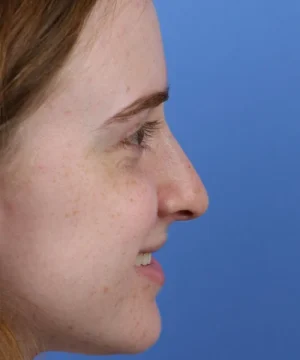 Side profile of a person smiling against a blue background.