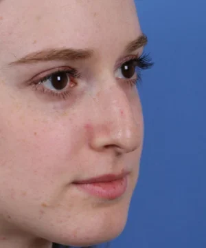 Close-up of a person's face in profile against a blue background.