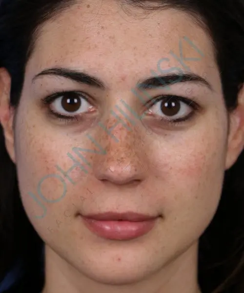 A woman with dark hair and brown eyes looks directly at the camera. She has freckles and neutral-expression lips.