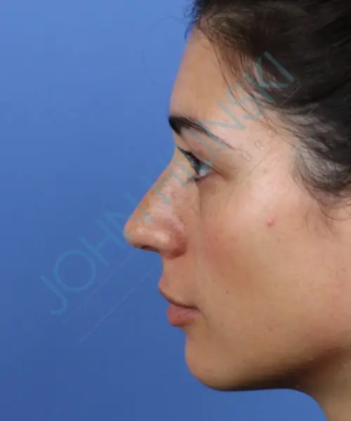 Profile view of a woman with long dark hair facing left against a blue background.