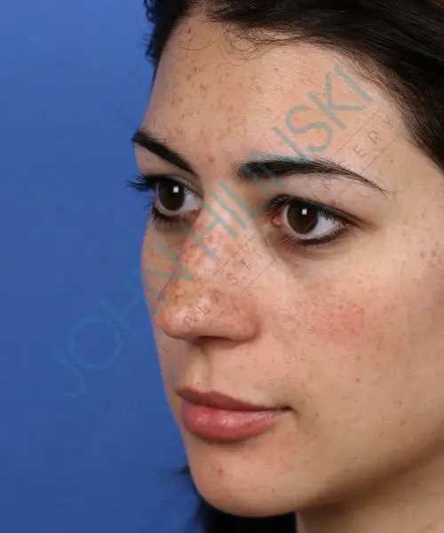 A woman with dark hair and freckles is shown in a profile view against a blue background.